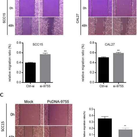 Downregulation Of Hsa Circ 009755 Enhances The Migration Of OSCC Cells