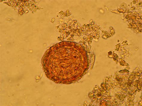 Ascaris Lumbricoides Huevo