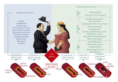 Traditional And Nontraditional Risk Factors For Cardiovascular Disease