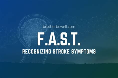 Fast How To Recognize Stroke Symptoms Brother Be Well