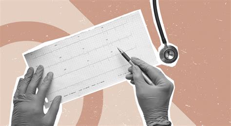 ECG vs. EKG: Is There a Difference? | Healthnews