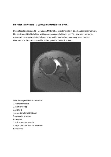 Samenvatting Anatomie Van Mri Beelden Schouder Transversale T1