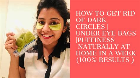 How To Get Rid Of Dark Circles 100 Results Under Eye Bags Puffiness Naturally In A Week