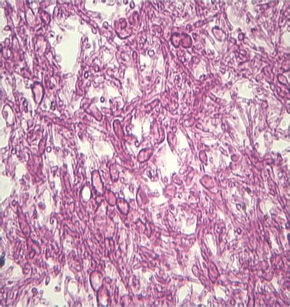 Carbohydrate Staining Flashcards Quizlet