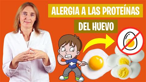 Cómo prevenir la alergia al huevo en bebés Bebés con alergia al huevo