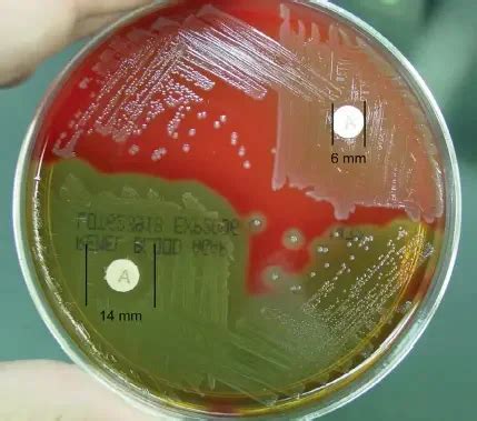 Bacitracin Susceptibility Test Principle Procedure Result Biology