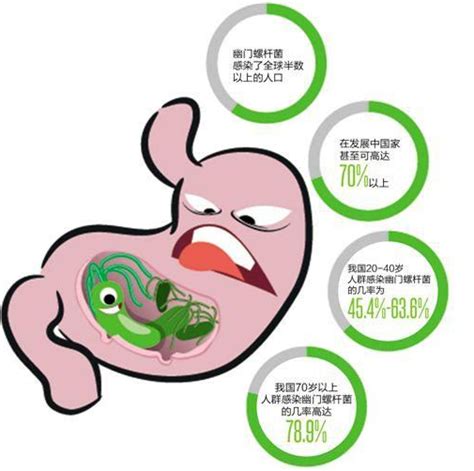 慢性胃炎与消化性溃疡有何区别？不注意警惕癌变！ 知乎