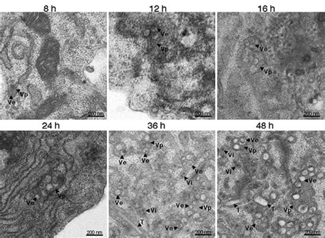 Progression Of An Enveloped Virus Replication Dengue Virus In C6 36