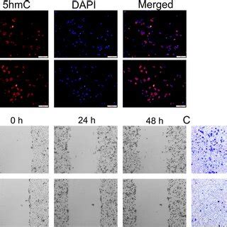 Effect Of Quercetin Treatment On Apoptosis And Cell Cycle Status Of