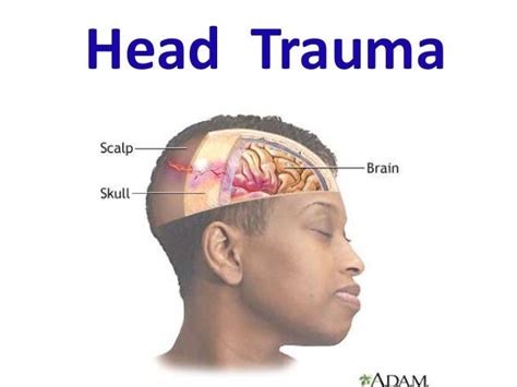 Head trauma