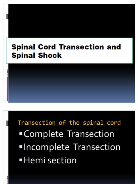 Spinal Shock | PDF | Spinal Cord | Neuroanatomy