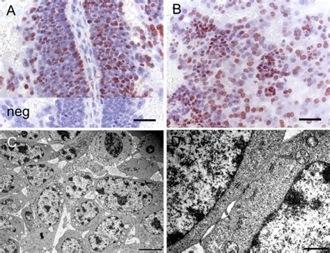 Chorioallantoic Placenta Of The Capybara At The Limb Bud Stage Ii A