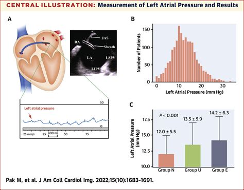 Jacc Journals On Twitter How Well Do Echofirst Lv Filling Pressures