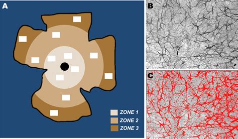 Rat Retinal Whole Mount A Division Of The Retina In Concentric Zones