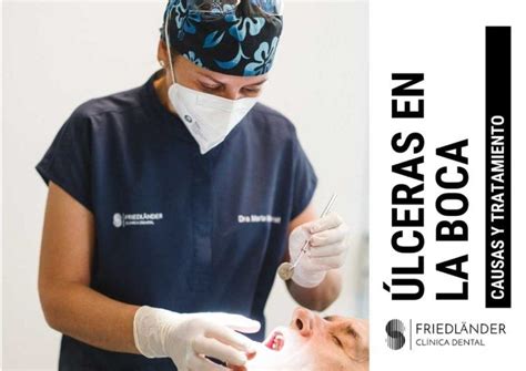 Qué Es Y Cómo Curar úlceras En La Boca Clínica Friedländer