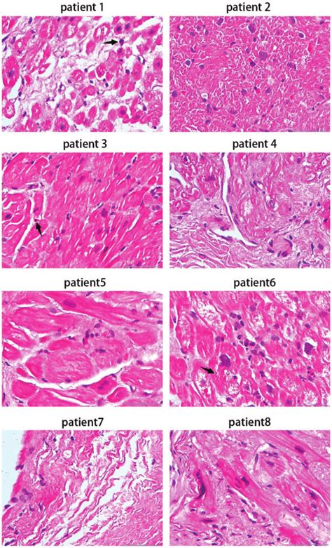 Representative Photomicrographs Showing Von Kossa Staining Of Download Scientific Diagram