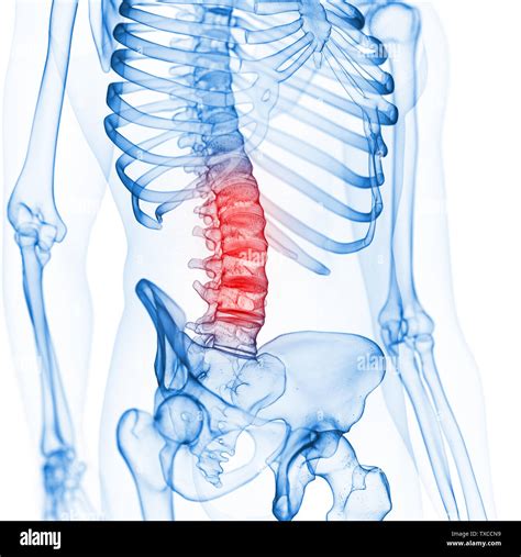 Lumbar Spinal Fotograf As E Im Genes De Alta Resoluci N Alamy