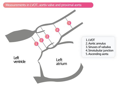 Aortic Stenosis Echocardiography Diagnosis Grading Causes Management