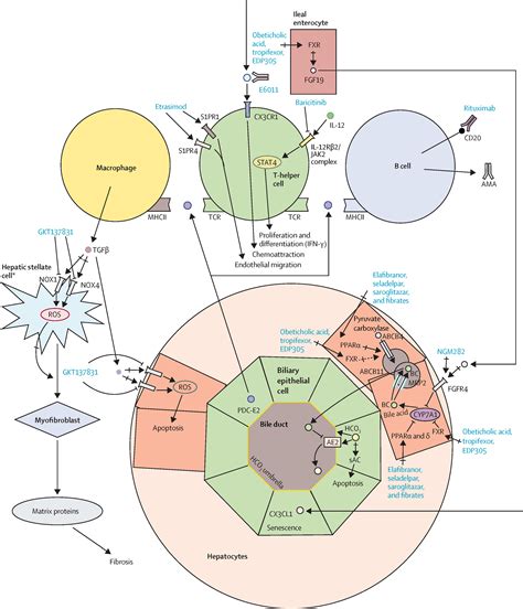 Primary Biliary Cirrhosis Stages Formula