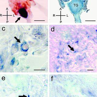 Double Staining For Nadph Diaphorase Histochemistry And Cyclic Gmp Like