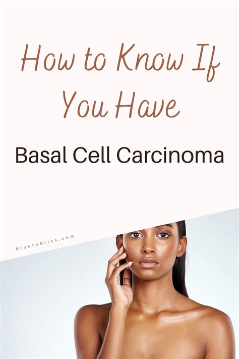 How To Know If You Have Basal Cell Carcinoma Artofit