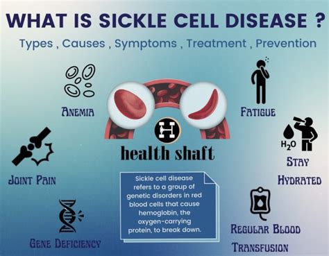 Everything About Scd Sickle Cell Disease Health Shaft