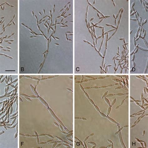 Cladosporium Oxysporum Cbs 125991 Macro And Micronematous