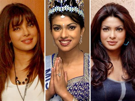 Priyanka Chopra Perfect Plastic Surgery For Miss World