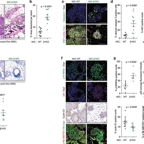 β1 integrin deletion results in cell detachment proliferative block