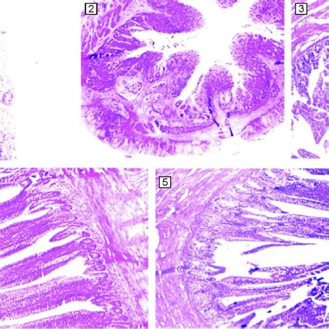 Photomicrograph Of Small Intestine Showing Normal Morphology In T