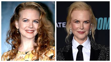 Nicole Kidman Sorprende Con Una Nueva Cara Sabemos Cuánto Le Ha Costado