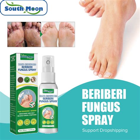 South Moon 30ml Foot Fungus Treatment Spray Anti Beriberi Infection