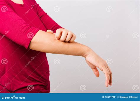 Asian Beautiful Woman Itching Her Scratching Her Itchy Arm Stock Image