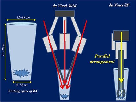 Comparison of working space between DaVinci Si/Xi and the DaVinci SP ...