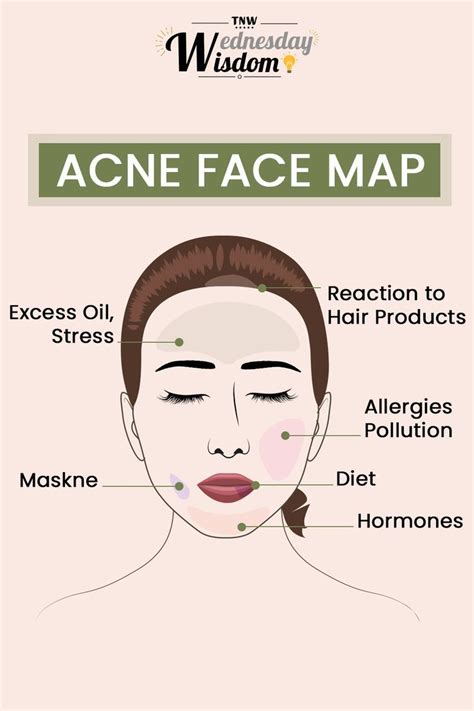 Reasons For Acne On Different Parts Of Face