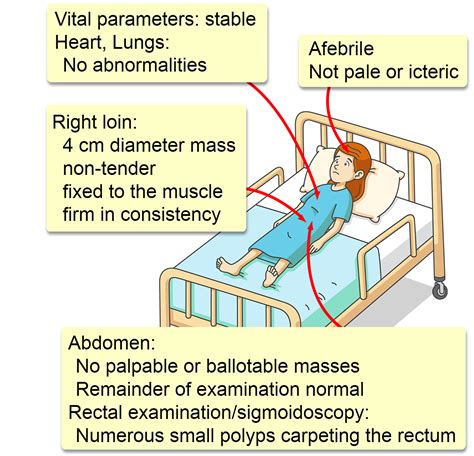 Gardner's Syndrome - Interactive case study | Clinical Odyssey by Medical Joyworks, LLC