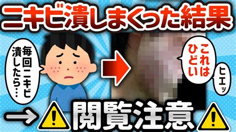 【2ch有益スレ】ニキビ潰しまくったらどうなるの？【ゆっくり解説】 Youtube