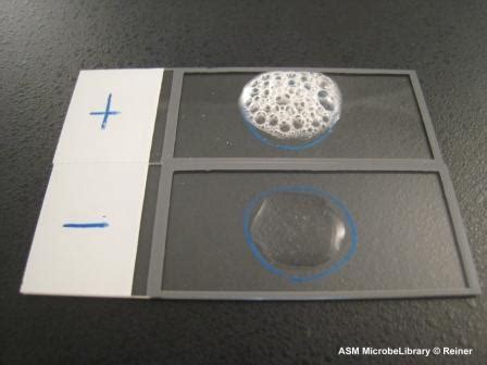 Catalase Test | ASM.org