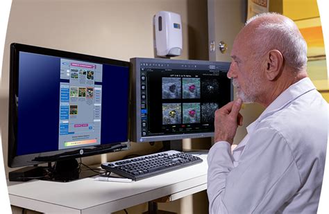 Experience Imagio Oa Us Breast Imaging System Seno Medical