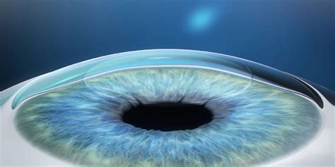 A Complete Guide To Types Of Lasik Surgery Neoretina