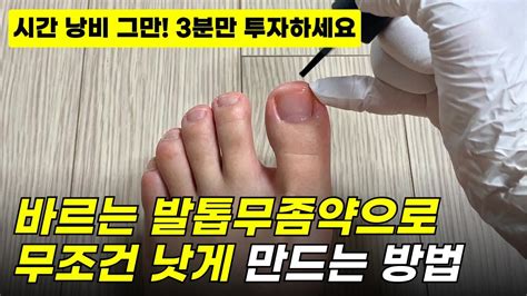 바르는 발톱무좀약 낭비하지 말고 3분만 투자하세요 Youtube