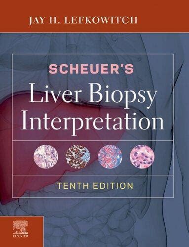 Scheuers Liver Biopsy Interpretation 10th Edition Twin Sea Star