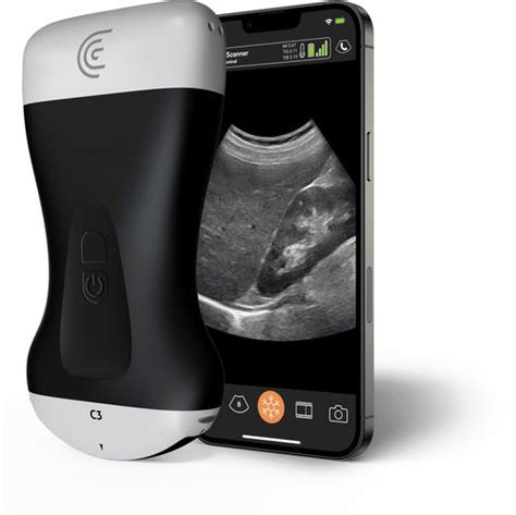 Clarius Hd Ultrasound Alpha Medtech Limited