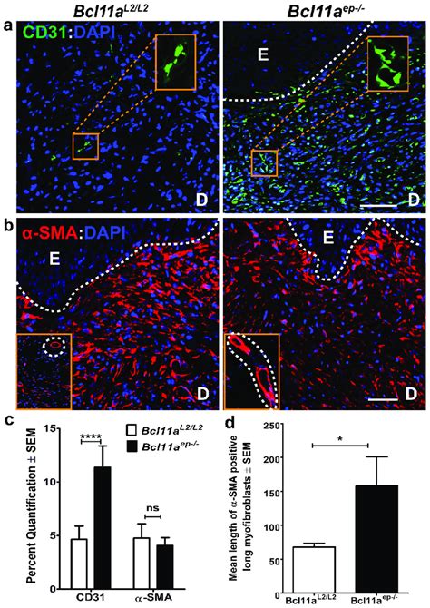 Non Cell Autonomous Role Of Epidermal Bcl11a Deletion In Facilitating