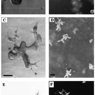 Induction Of Branching Morphogenesis By Hb Cells Cultured In