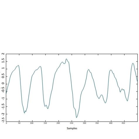 Comparison of automated shockable and non-shockable system using ECG... | Download Scientific ...