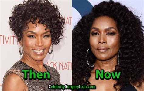 Angela Bassett Plastic Surgery Admits Botox Serum Injections