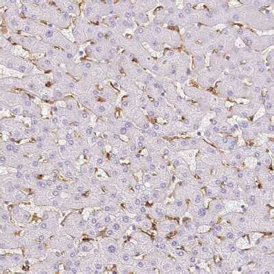 MMR CD206 Mannose Receptor Antibody NBP1 90020 Novus Biologicals