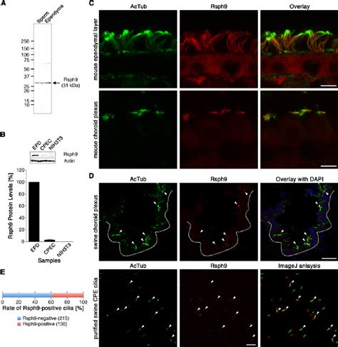 Immunological Analysis Of Rsph A Western Blot Analysis For Rsph