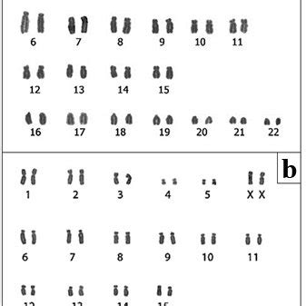 Conventionally Stained Karyotype Of A Male Callithrix Sp With